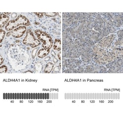 ALDH4A1 Antibody, Novus Biologicals:Antibodies:Primary Antibodies